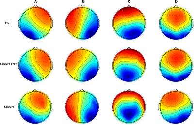 Altered Resting-State Electroencephalography Microstates in Idiopathic Generalized Epilepsy: A Prospective Case-Control Study